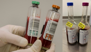 Effect of variations in clinical practice on blood culture volumes ...