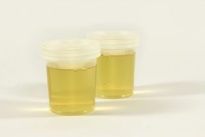 candida in urine