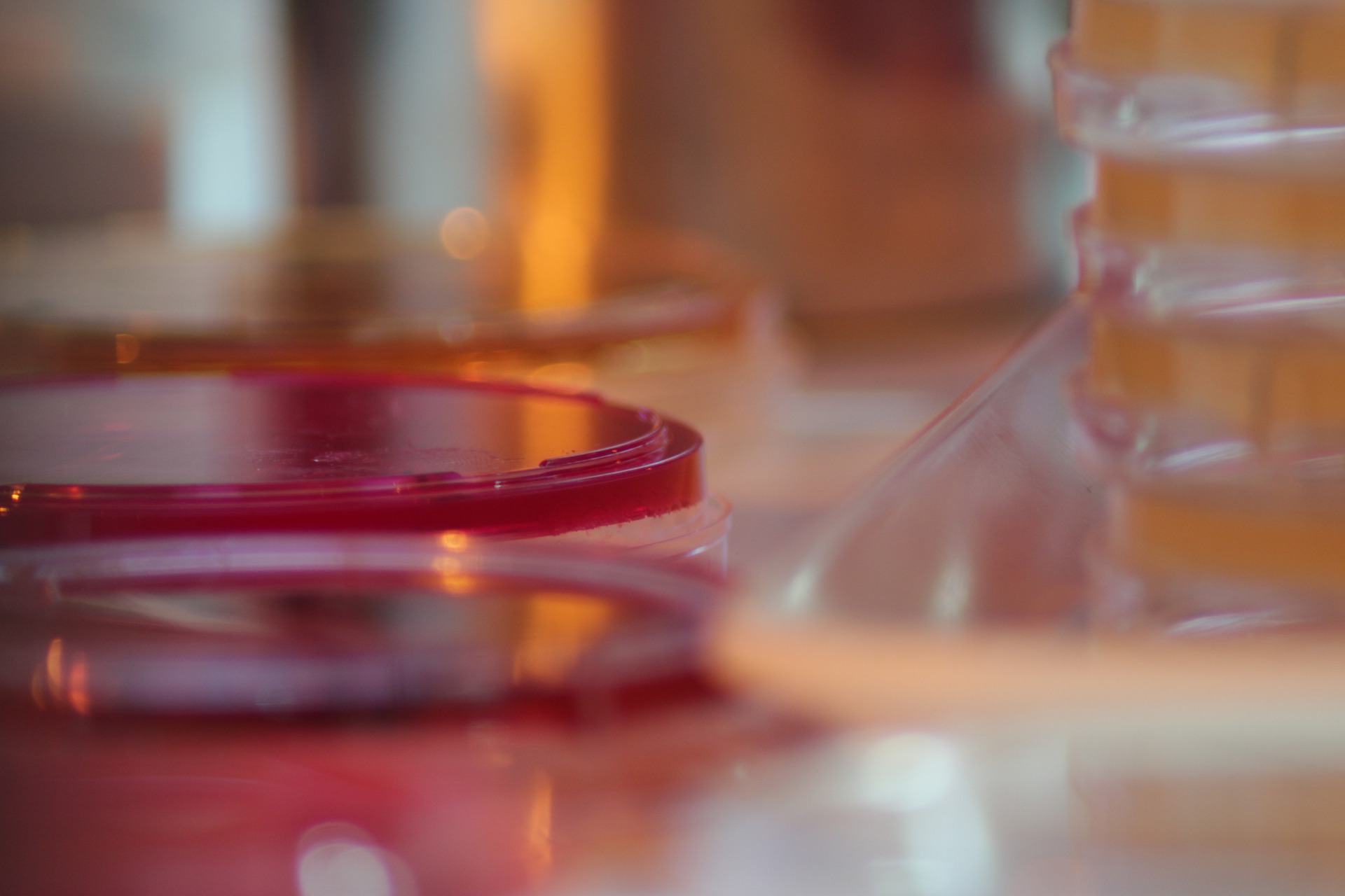 Changing the Culture of Culturing Division of Infectious Diseases