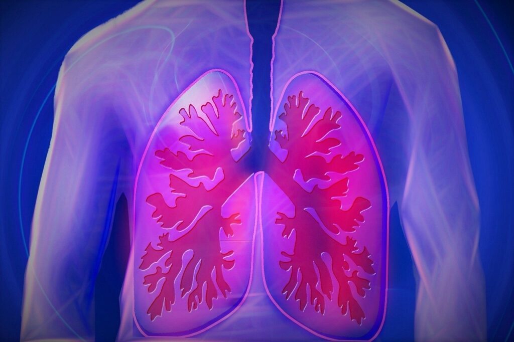 overlaying a dark blue background, is a graphic of a human chest, and overlaying this are a pair of lungs with abnormally widened airways