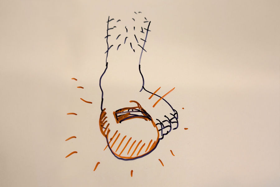 Left ankle and foot with an enlarged big toe doodle by Dr. Wigton